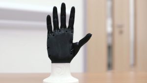 3d printed Prosthetic Limbs
