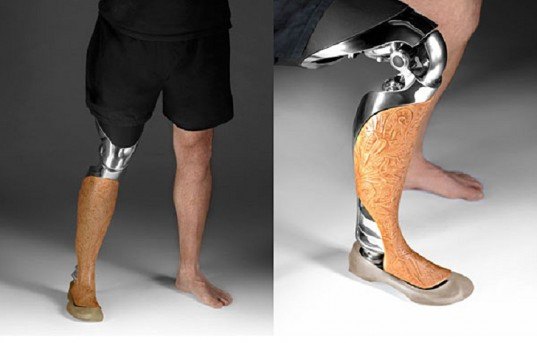 3D Printed Customized Prosthetics