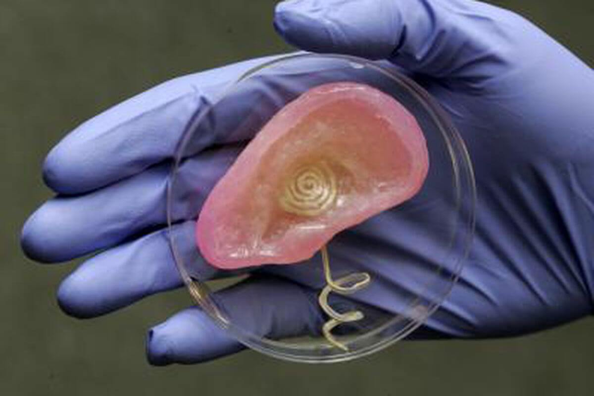 Printing of Ear Cartilage