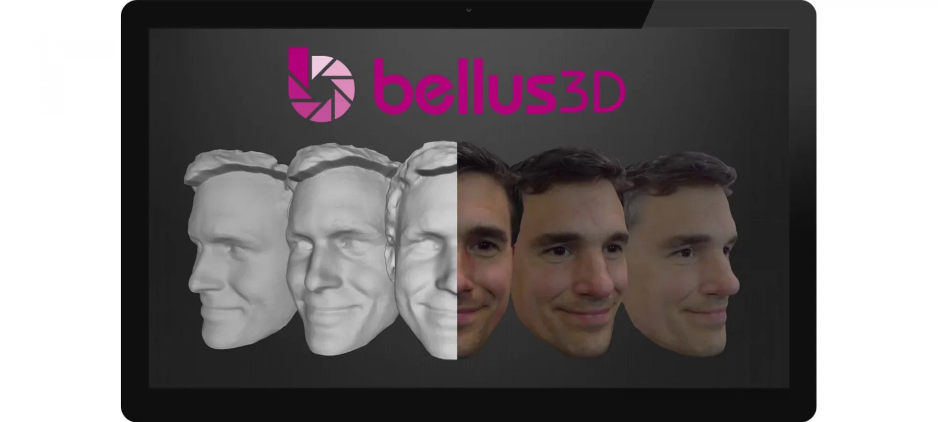 bellus 3D