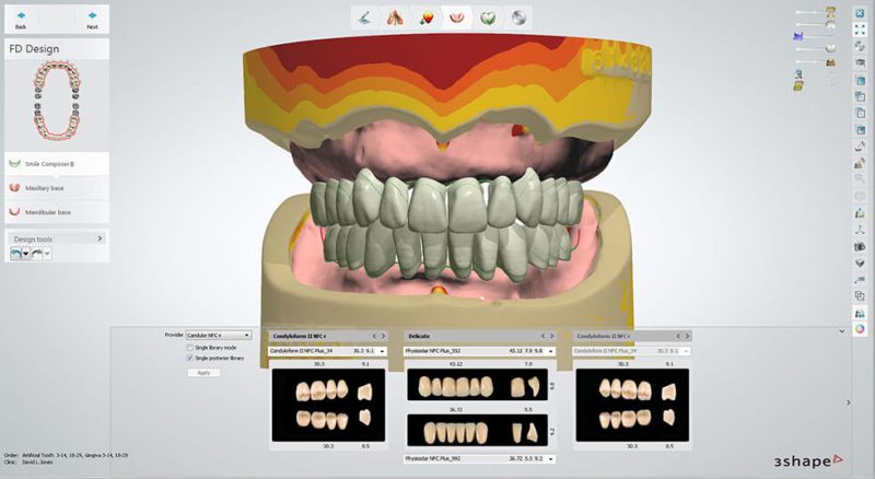 Vida HD Crown & Bridge 3D Printer software