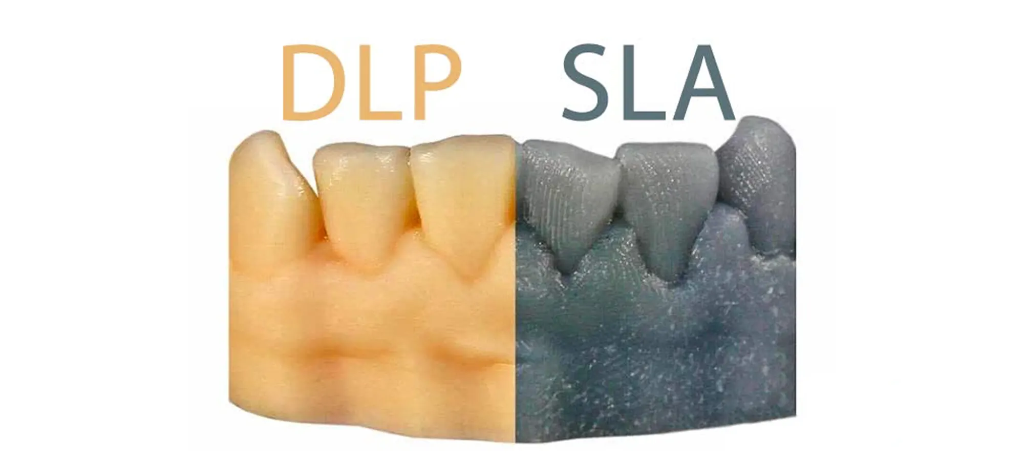 dlp vs sla