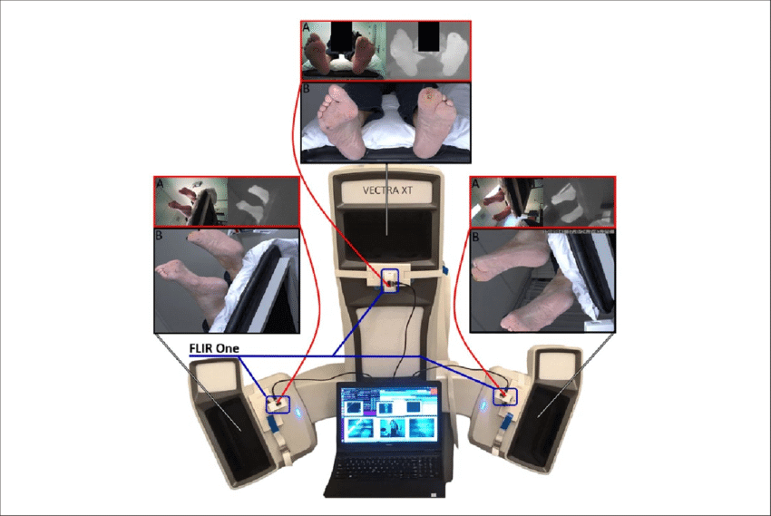 Canfield Vectra XT 3D Scanner scan type